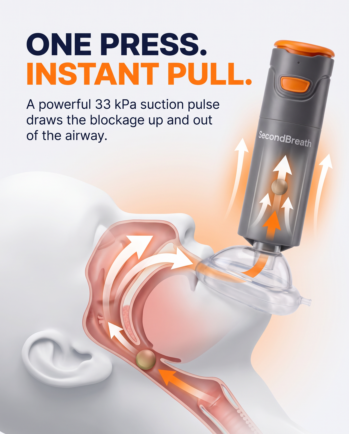 SecondBreath™ - Anti-Choking Device