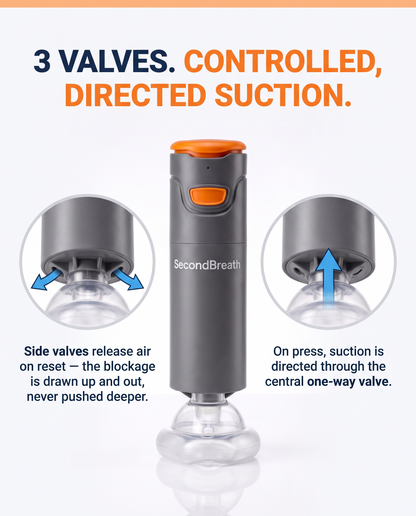 SecondBreath™ - Anti-Choking Device